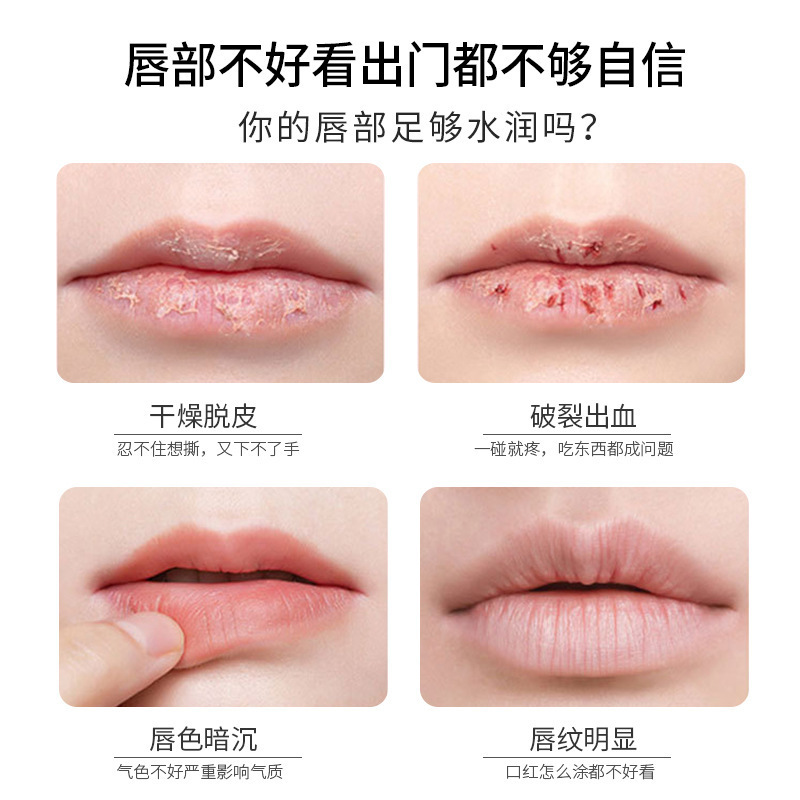 Kan Era Girls' Autumn and Winter Lip Care Lip Balm Nourishing Moisturizing Anti-Chapping Non-Dry Herb Essence Lip