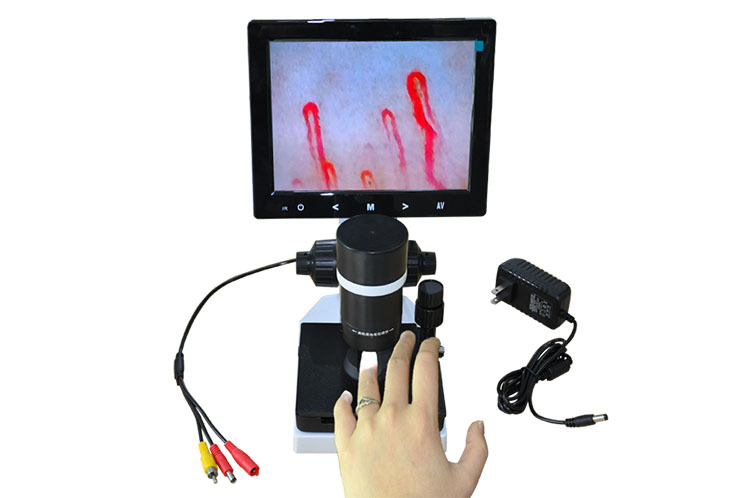 末梢血管血液透视仪 甲壁微循环检测仪 血液流速分析仪 视频对比