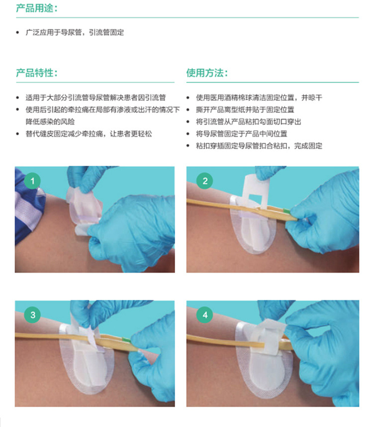 鼻胆管固定方法图片图片