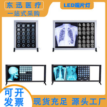 X光观片灯LED灯箱医学影像灯骨科单三联手术CT胶片阅片灯四联调光