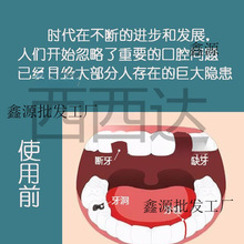 补牙神器自己在家补牙蛀牙补牙齿洞树脂材料门牙套牙仿真缺牙牙套