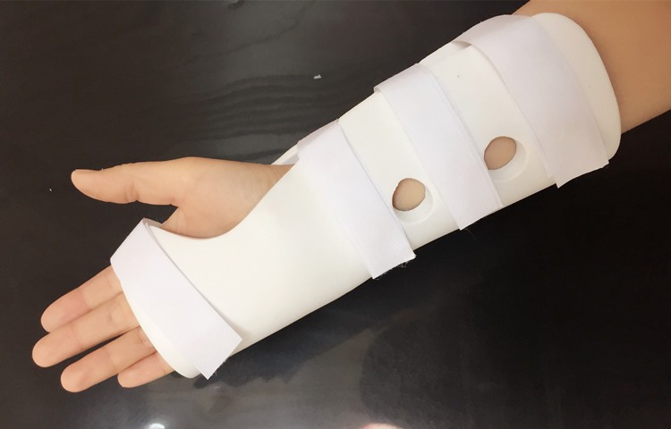 高分子挠骨骨折夹板手腕扭伤固定支具骨裂护腕后石膏前臂三角固定