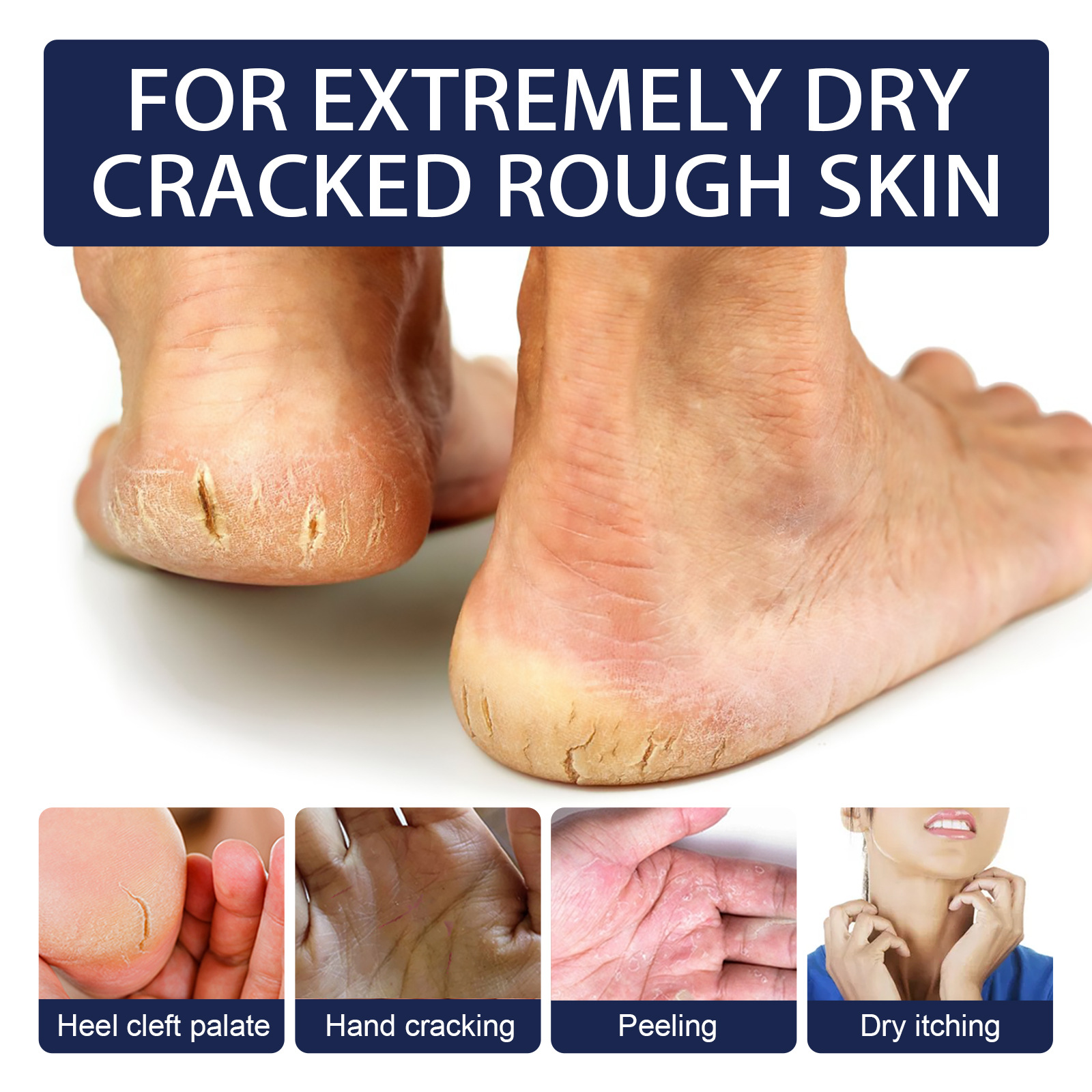 Jaysuing Anti-Cracking Repair Hand Cream Moisturizing Exfoliating Skin Improve Cracking Rough Skin Hydrating Hand Cream