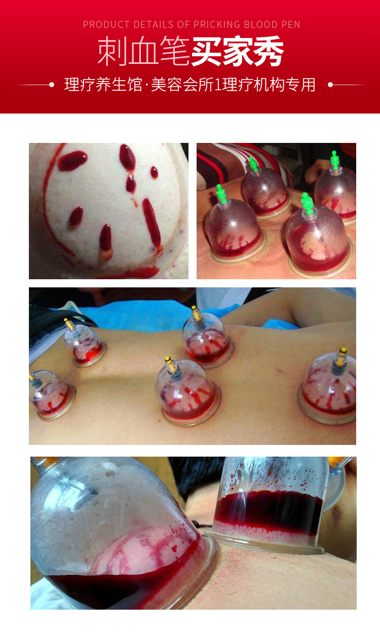 aem三头采血针笔刺血针刺络放血笔拔罐非无痛泻血一次性排瘀家用