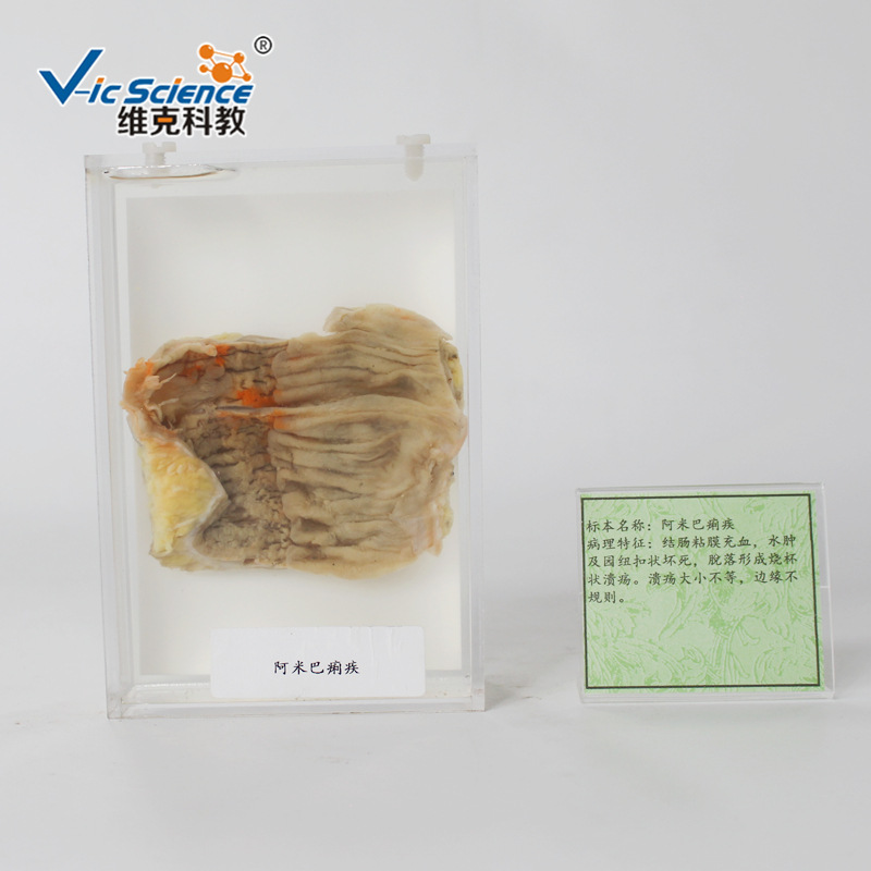 维克科教医学院卫校教学使用大体病理标本阿米巴 痢 疾 病理标本