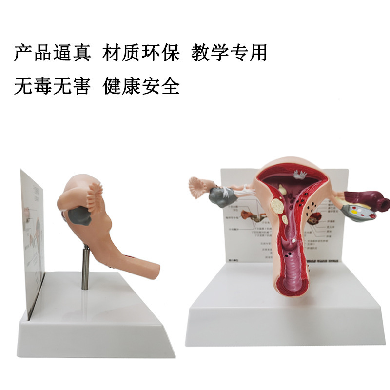 ly human anatomy model uterine lesion model female internal reproductive system reproductive structure ovarian display teaching