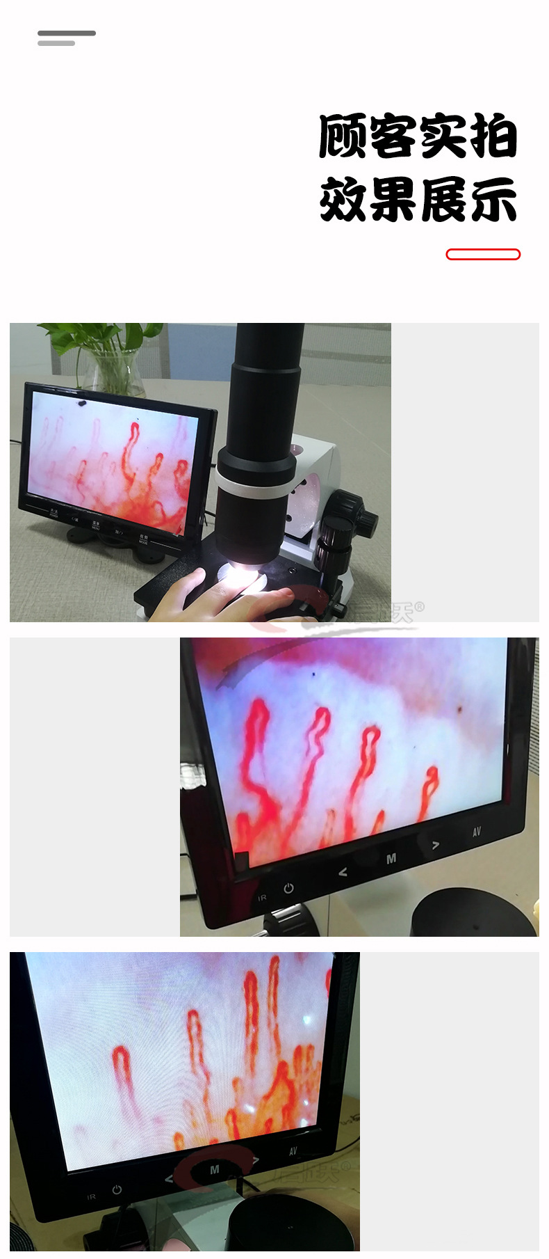 广州启跃qy990高清微循环检测仪末梢血管观察显像仪看手指显微镜