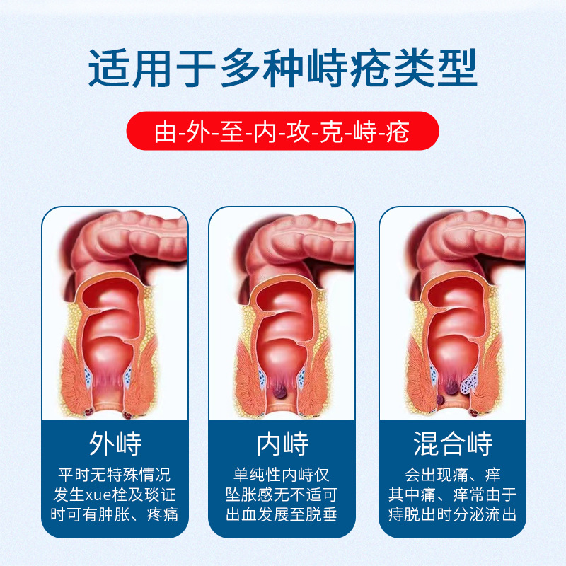 痔疮膏oem贴牌加工内外肉球痔疮混合肛门瘙痒痔疮栓凝胶odm定制