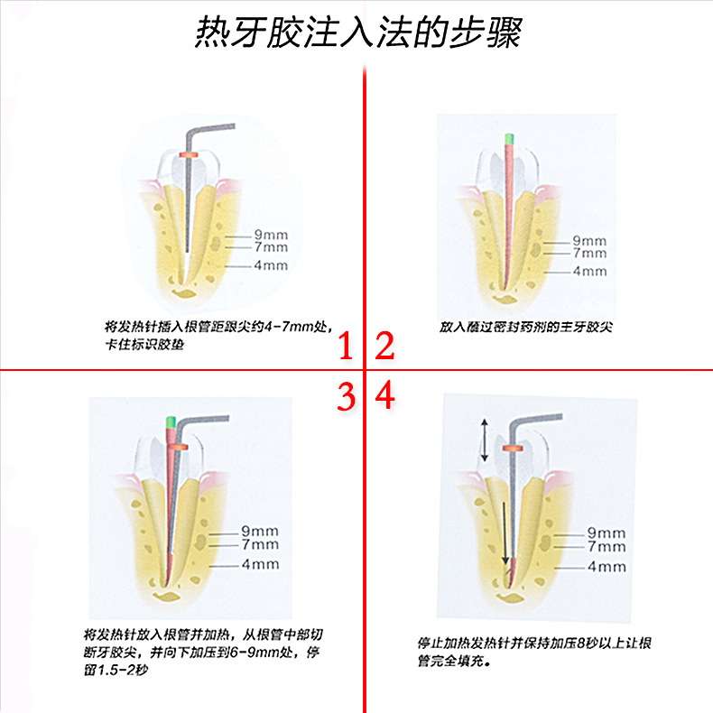 牙胶尖热熔笔 切断器 口腔热充填加热牙科填充笔热牙胶欧规美规