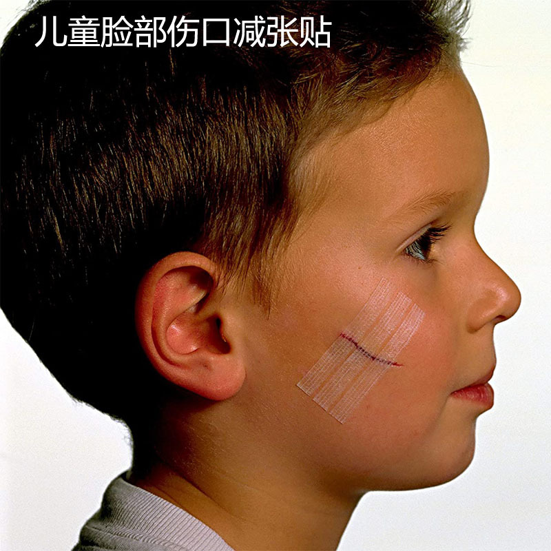 免缝胶带拉合减张胶布剖腹产预防疤痕增生美容提拉胶带10张 包邮