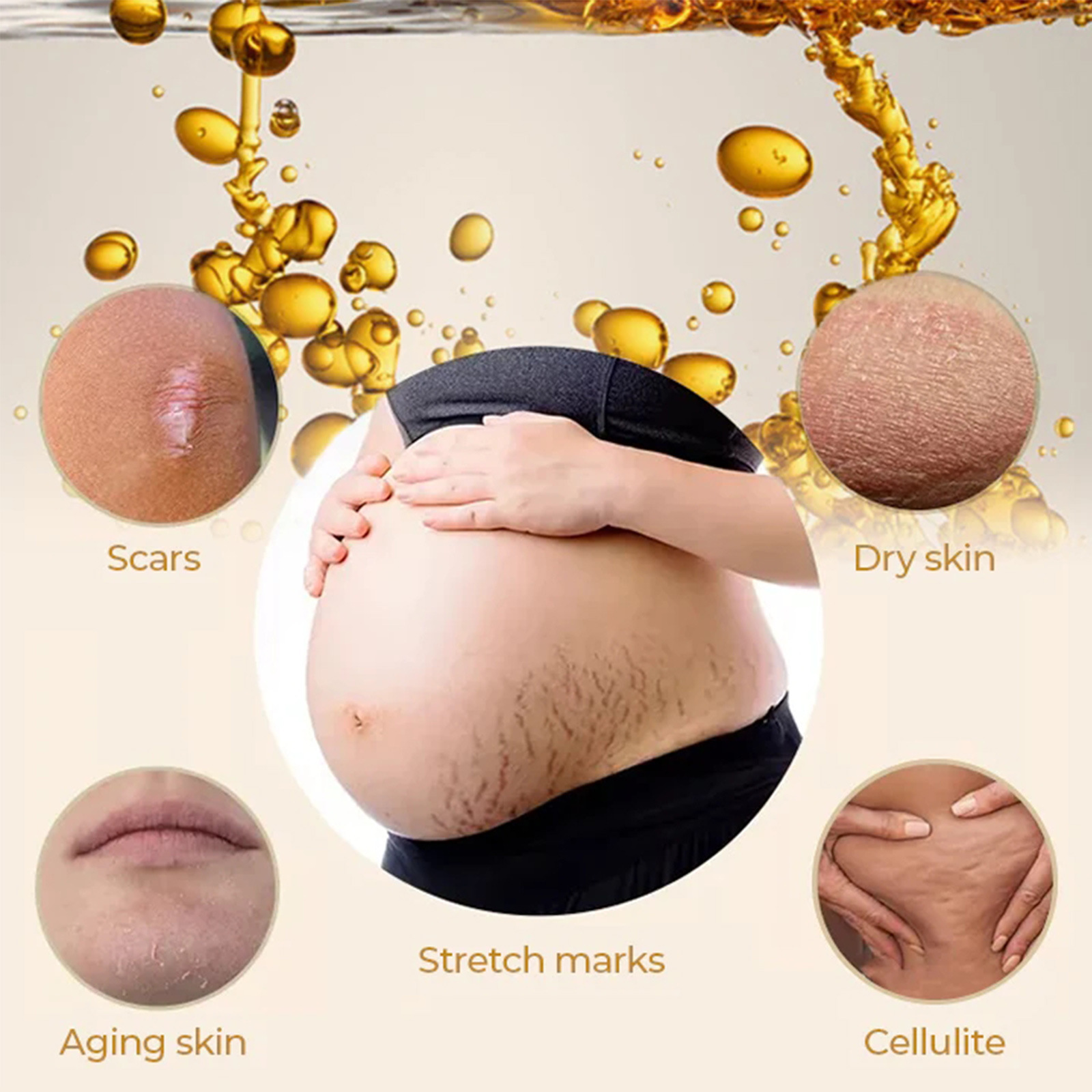 Eelhoe Olive Pregnancy Recovery Oil Moisturizing Smooth Firming Skin Repair Postpartum Pregnancy Obesity Treatment Oil