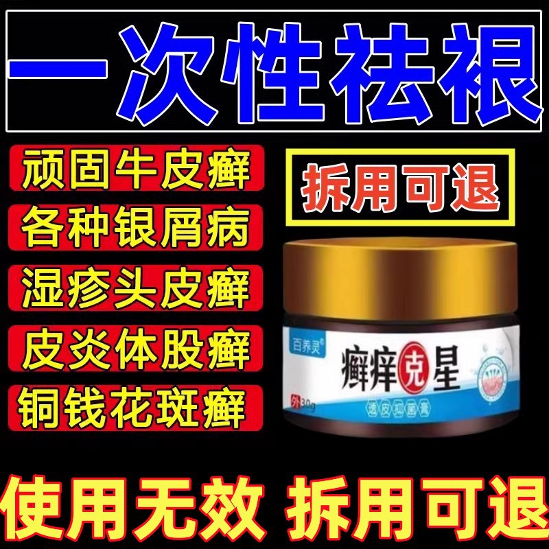治头皮屑癣脂溢性皮炎银屑病特效药牛皮癣头屑头痒头皮癣专用药膏