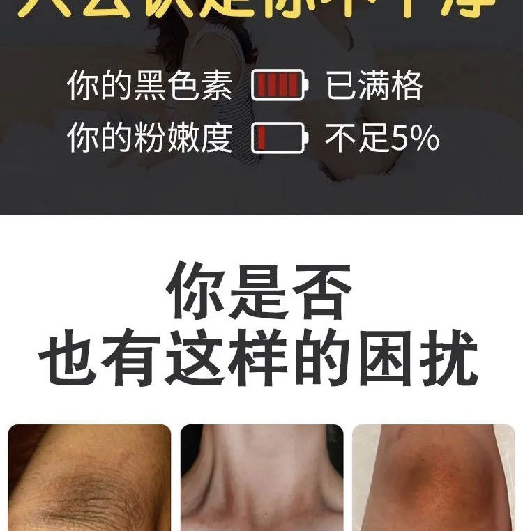 白愈腚乳膏关节手肘胳膊肘去黑死皮脖子腋下去黑色素脚踝膝盖变白