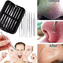 3-8Pcs Blackhead Acne Pimple Remover Needle Stainless Steel