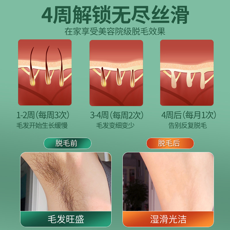 家用激光脱毛仪器全身腋下私处去毛女士专用剃毛机