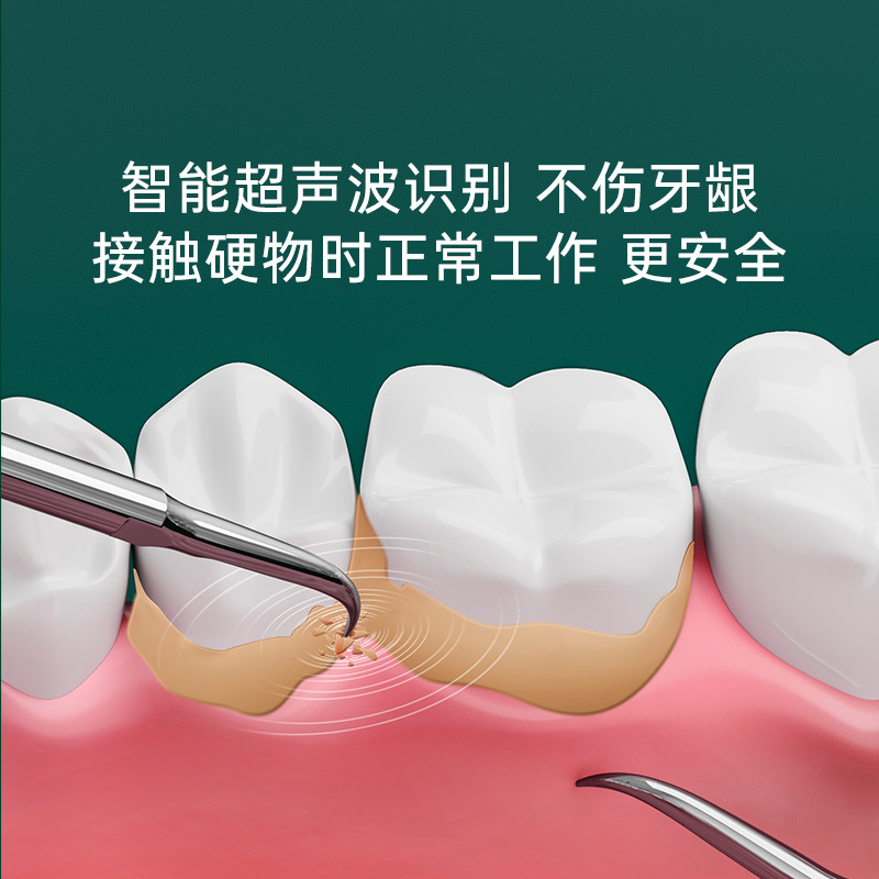 tflash同诗超声波洗牙器洁牙仪牙结石去除器洗牙齿污垢除牙垢神器