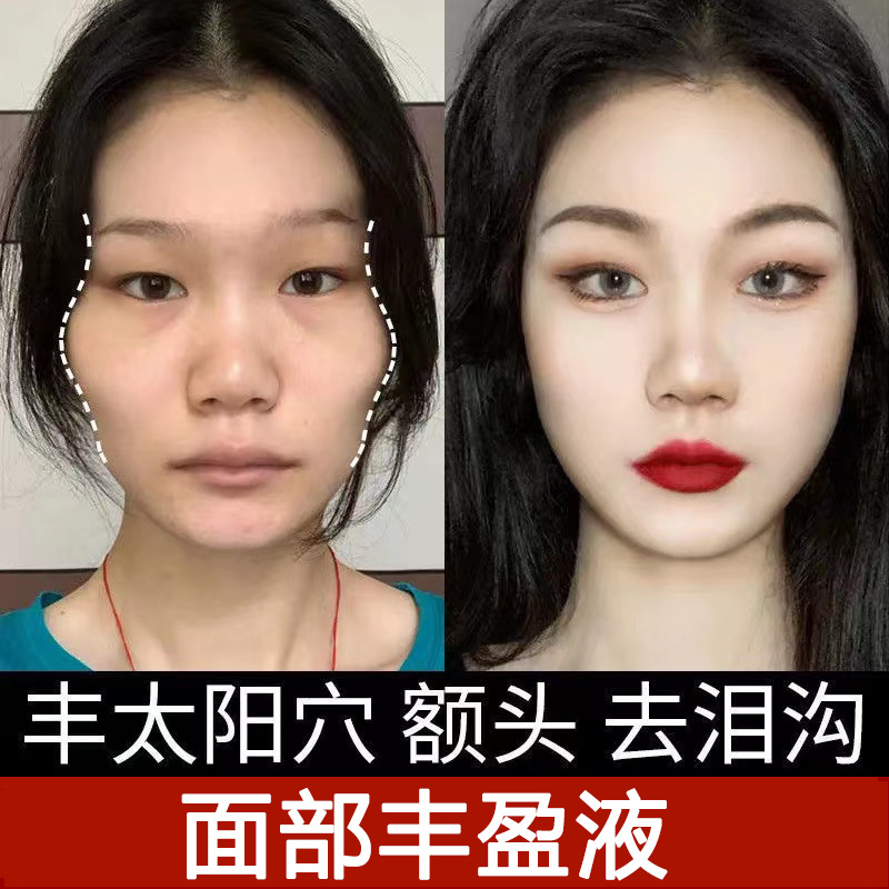 面部丰盈液告别凹陷太阳穴泪沟苹果肌脸部凹陷脸部填充原液-阿里巴巴