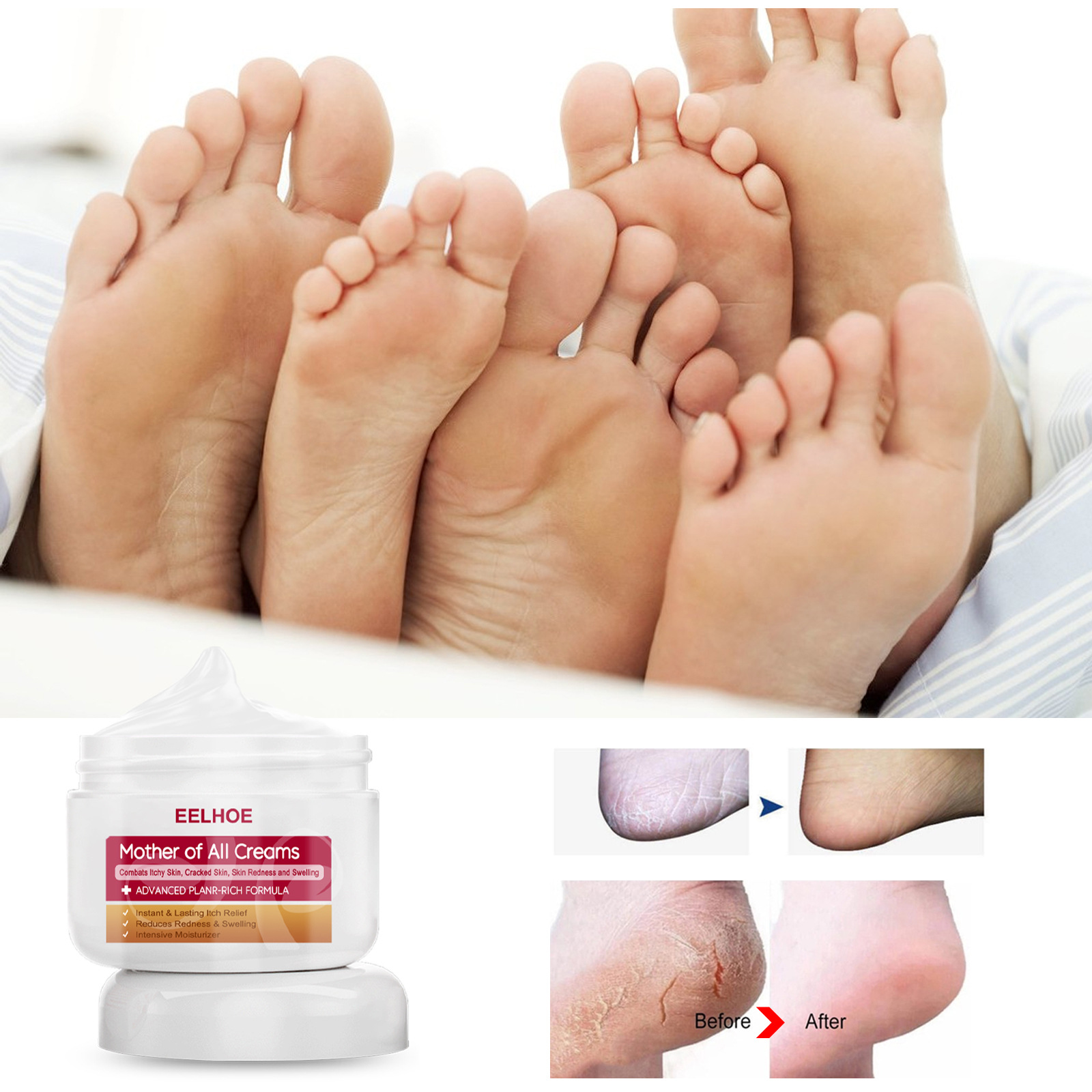 Eelhoe Skin Moss Hands and Feet Moisturizing Cream Repair Relieve Itching Relieve Itching Moisturizing Skin Hydrating Moisturizing
