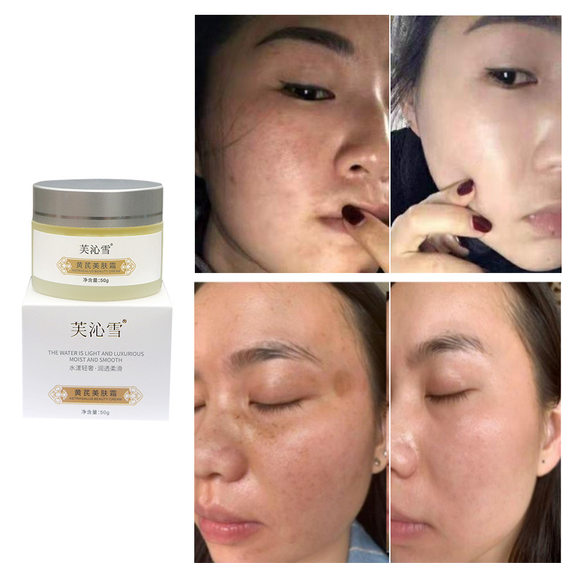 美白祛斑霜淡化色斑黄芪祛斑霜377祛斑霜黄褐斑黄芪霜美白去斑霜