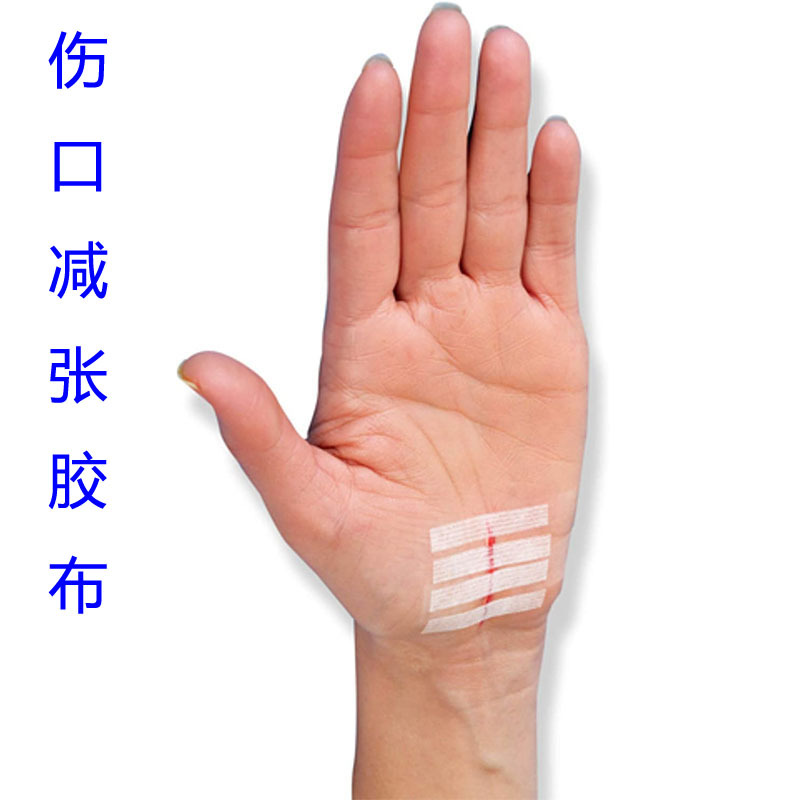 免缝胶带拉合减张胶布剖腹产预防疤痕增生美容提拉胶带10张 包邮