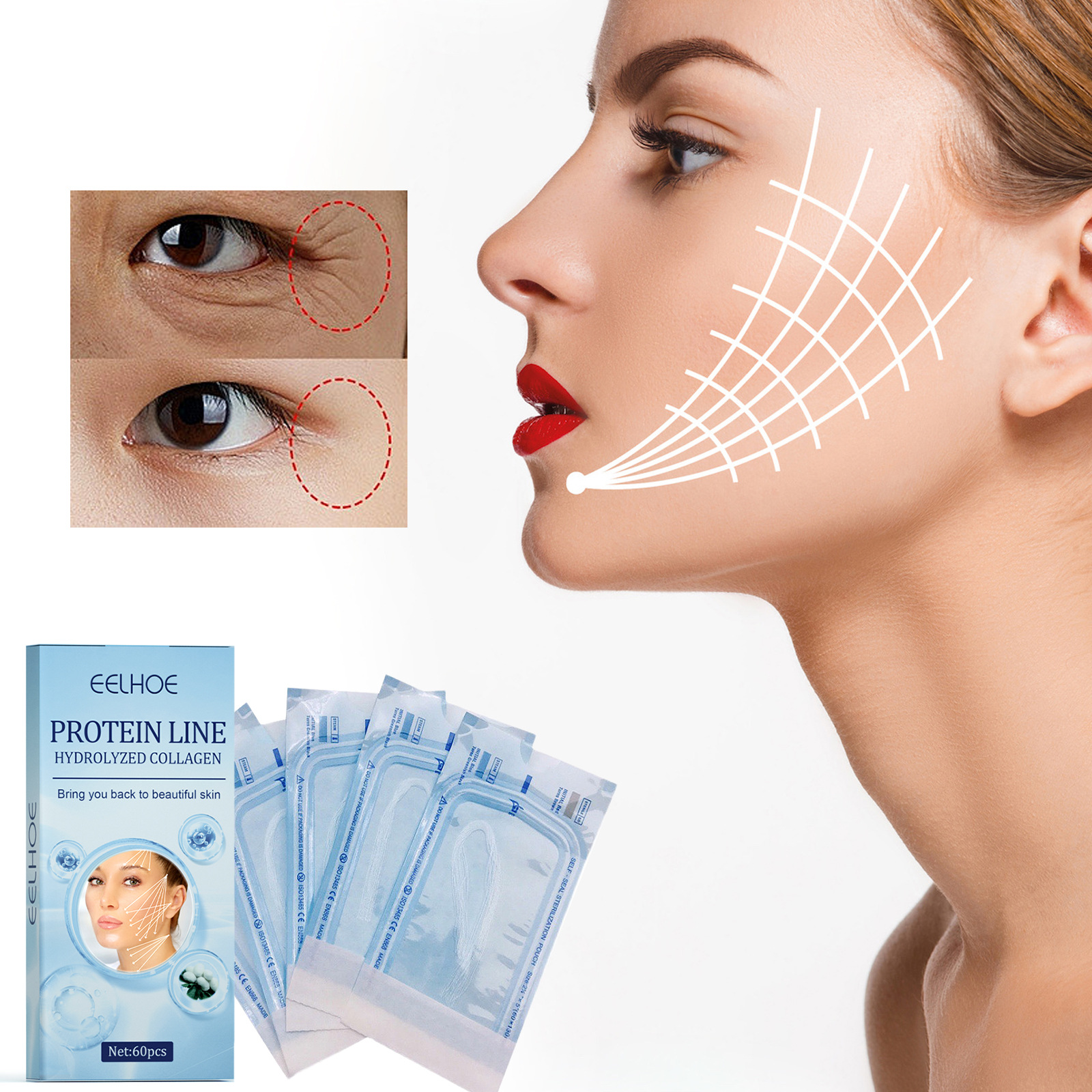 eelhoe 蛋白提升线淡化细纹盈润皮肤抗皱v脸提拉紧致松弛面部轮廓
