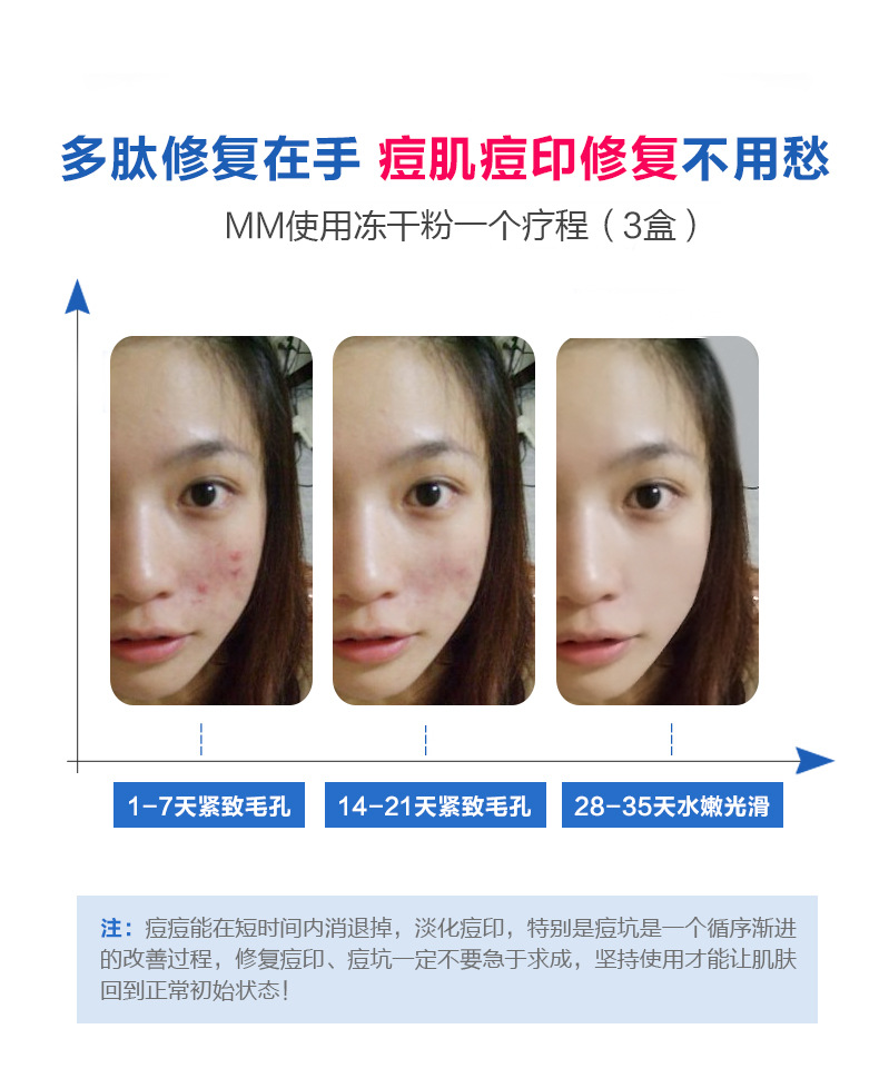 美容院淡化痘印痘坑晒后修复红血丝精华液寡肽修护冻干粉裸瓶oem