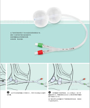 供应美国库克子宫颈球囊扩张导管J-CRB-184000 宫颈扩张导管