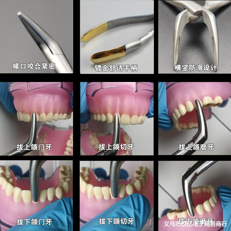 牙钳子拔牙