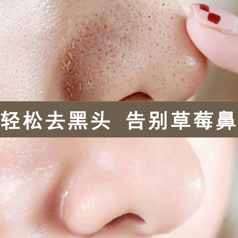 净化黑头导出液