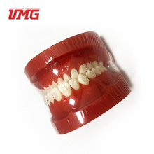 UM-B8牙科教学用口腔模型牙齿矫正模型陶瓷托槽正畸操作训练模具
