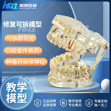 牙科模型口腔科病理医患沟通教学体综合带神经可拆卸牙模