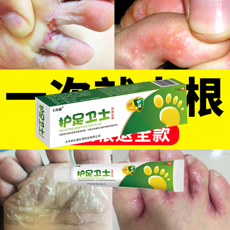 脚丫王脚气喷剂脚丫软膏去脚臭脚痒烂脚丫水泡脱皮脚汗克星护足霜