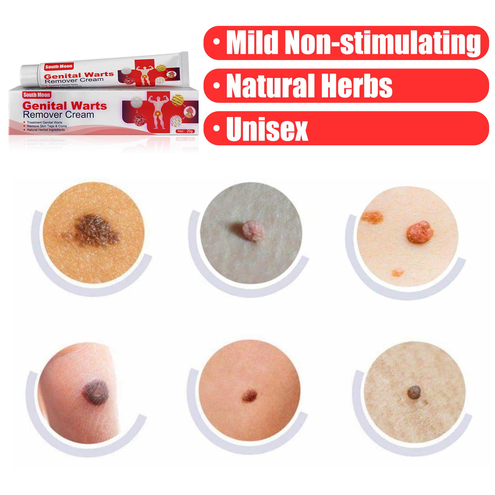 平猴尤祛疣膏皮肤抑菌膏手足脸部丝状平抑瘊疣腋下肉粒脖子克疣膏