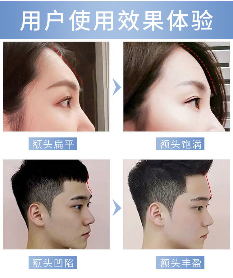 填充精华霜丰脸精油丰太阳穴丰脸丰额头丰泪沟填充苹果肌丰盈精华