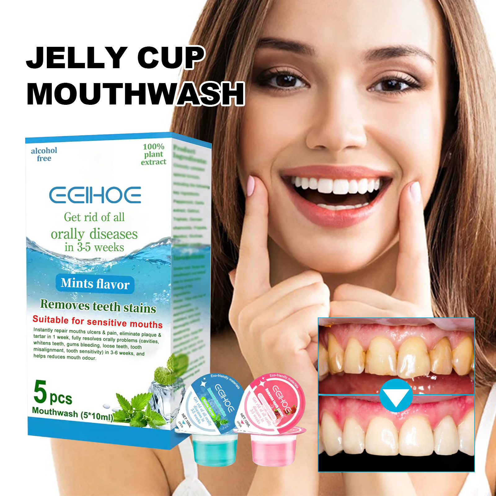 Eelhoe Jelly Cup Mouthwash Clean Oral Odor Tooth Stains Smoke Stains Bright White Teeth Care Fresh Breath