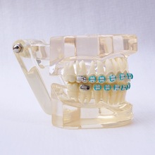 28颗牙,牙齿模型 全陶瓷托槽