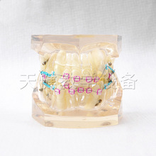 TJ-B8-03 全陶瓷牙模型24颗牙模型全陶瓷托槽口腔护理教学牙模型