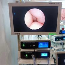 智能高清医用内窥镜摄像系统 1080P宫腹腔镜关节镜膀胱镜结肠镜