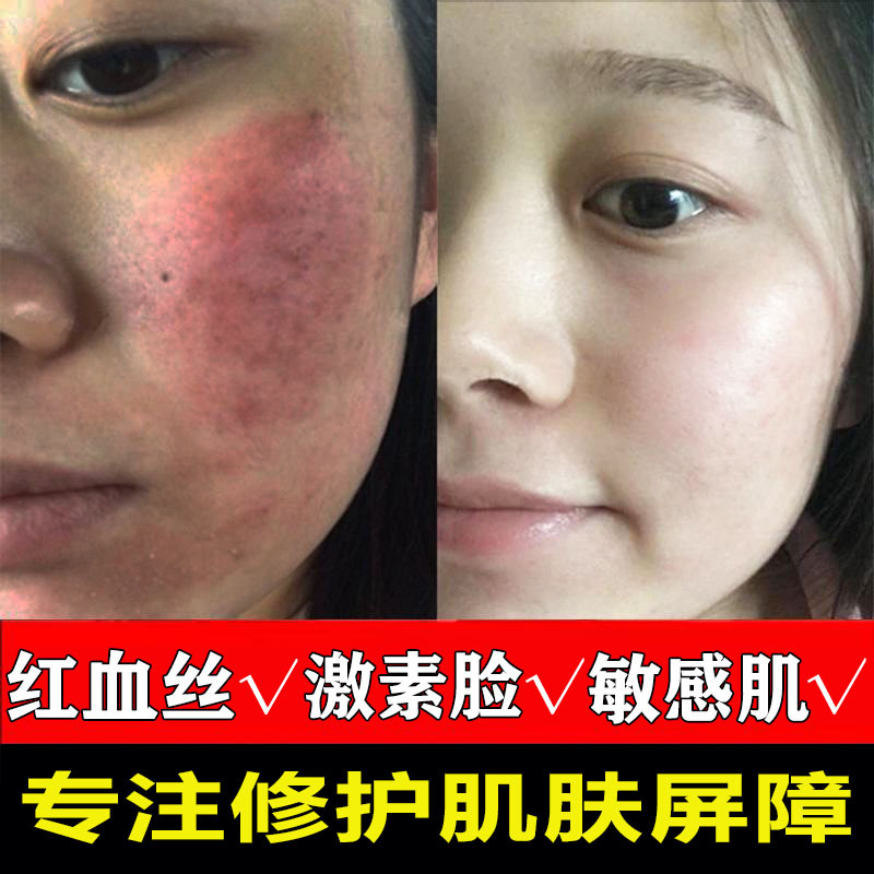 积雪草精华祛痘印修复敏感肌激素脸去红血丝补水面部修复精华液