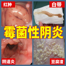 金鸡妇科抑菌凝胶千金苦参私处护理霉菌性阴豆腐炎渣女洗液正品mb