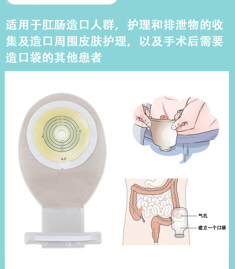 妥能肛肠一件式造口袋人工肛门袋大便造口护理用品直肠一次性造瘘