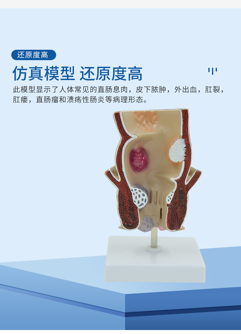 人体直肠痔疮病变解剖模型结肠肛肠科肛门括约肌教学医用标本