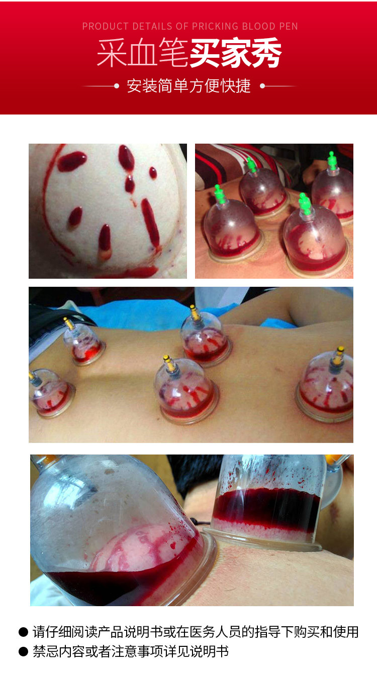 血糖采血针笔双开口中医放血针刺血笔拔罐用非无痛刺络泄血排瘀笔