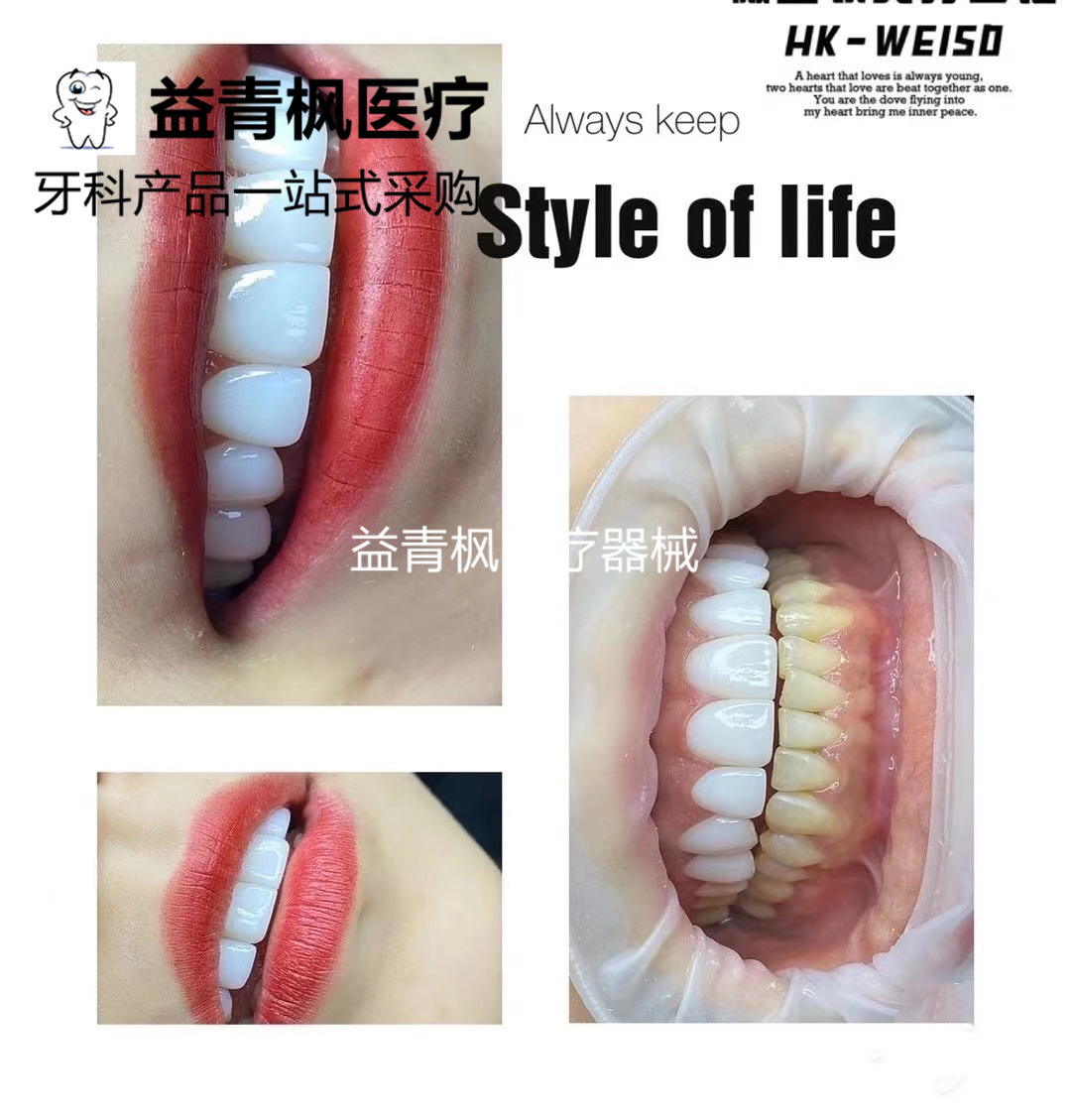 美牙全瓷冰瓷贴面贴片牙齿全瓷冰瓷贴面贴片材料厂家直发牙科材料