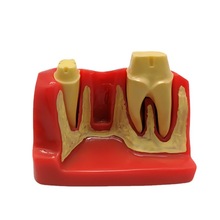 深圳厂家制作透明牙齿纸镇教学模型牙科口腔教学牙模四倍牙
