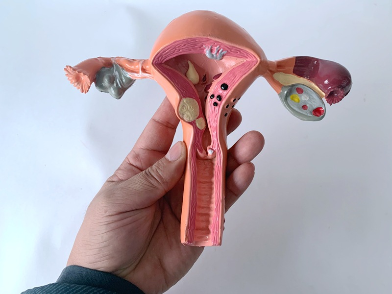 软胶生殖模器模型女性生殖模器模型私密子宫模型教具妇科卵巢病理
