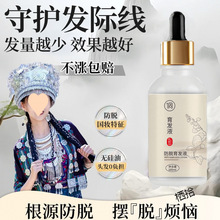 育发液养护头皮发际线后移产后脱发密发快速毛囊营华护发精油