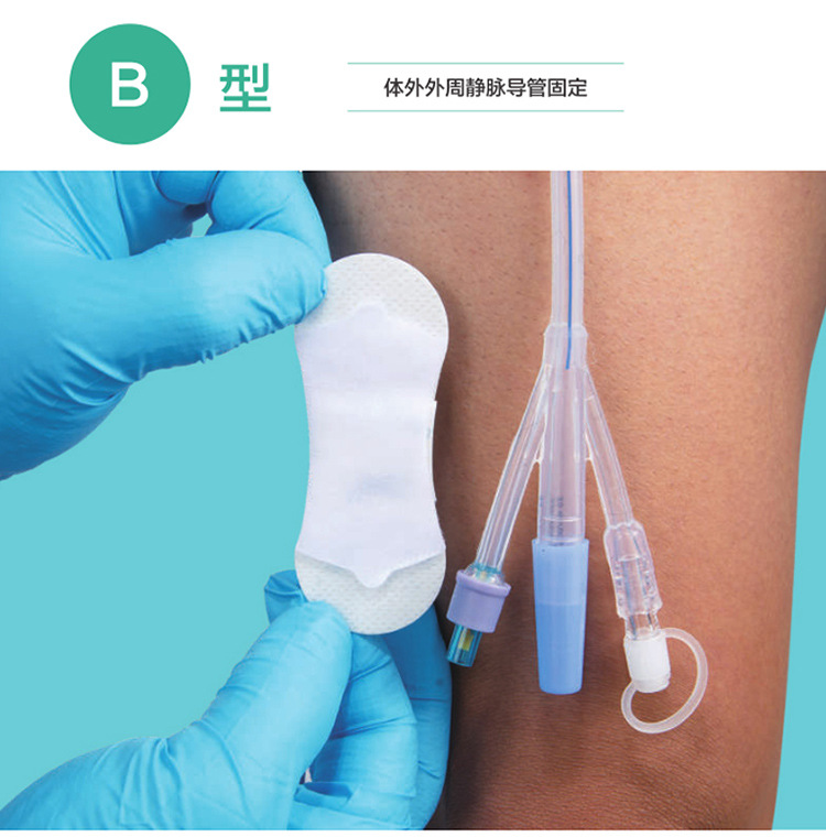 批发c1型picc体表导管固定贴腹透引流管导尿管固定装置鼻胆管敷贴