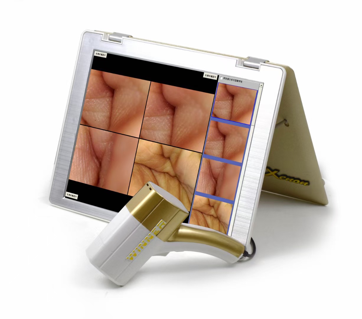 女人透视镜高清内窥镜电子私密妇科检测仪便携式一体机高清检测