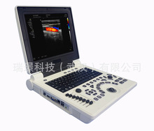 C2笔记本式彩色超声诊断仪,便携式彩超，彩色超声诊断系统
